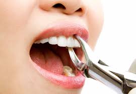 Лечение и удаление зубов